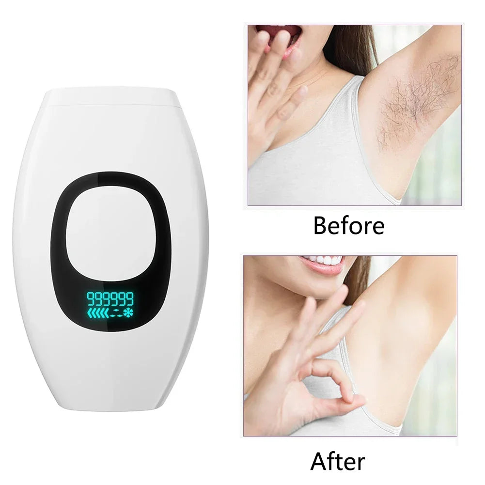 Handheld Laser Hair Removal Device